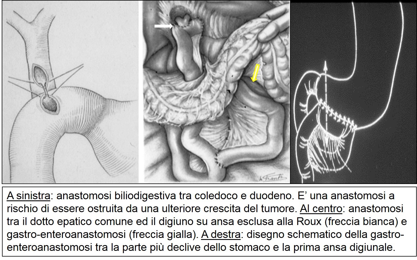 gastro-entero ed epatico digiuno